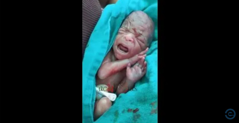 Prematuro: Recém-nascido resgatado vivo antes do enterro morre no Acre