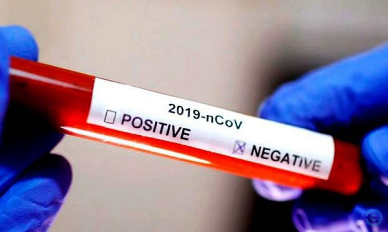 Testa negativo para Coronavírus exame de paciente que morreu no HR de Coxim